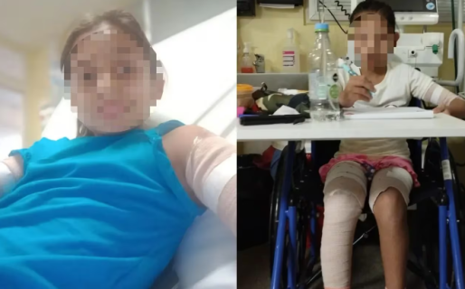 Una mujer denunció que un nene de 10 años prendió fuego a su hija por “celos”