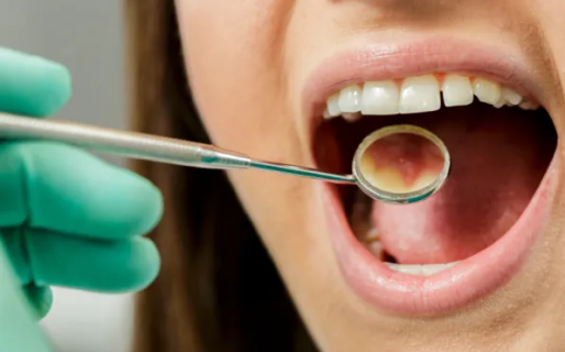 ¿Tienes lengua amarilla? Estas son la causas y posibles complicaciones