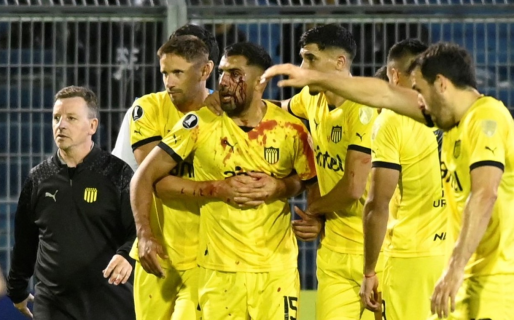 Central le ganó a Peñarol, pero está expuesto a graves sanciones por herir de un piedrazo a un jugador rival