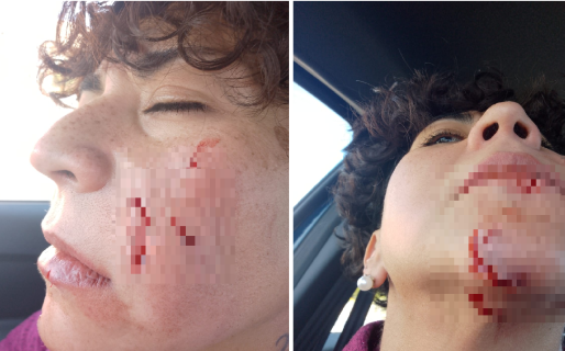 No murió de casualidad: brutal ataque de un pitbull en un partido de rugby en Chubut