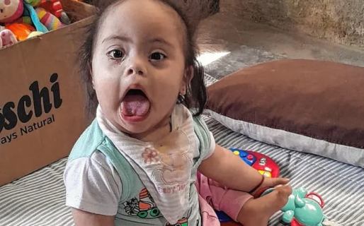 Solange necesita ayuda para una cirugía ocular