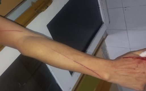 Detuvieron en una fiesta a un sujeto que atacó a su tío con un arma blanca