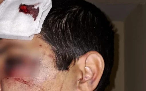 Una partida de truco entre amigos terminó en una violenta pelea