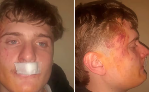 Brutal ataque de rugbiers a un joven de 19 años en una fiesta de Zárate: le pegaron patadas en la boca y la sien