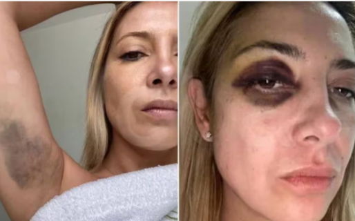 La denuncia de Fabiola Yañez contra Alberto Fernández: “Venís golpeándome hace tres días seguidos”