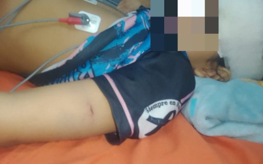 Un conductor alcoholizado los chocó y una menor de 8 años terminó con una fractura
