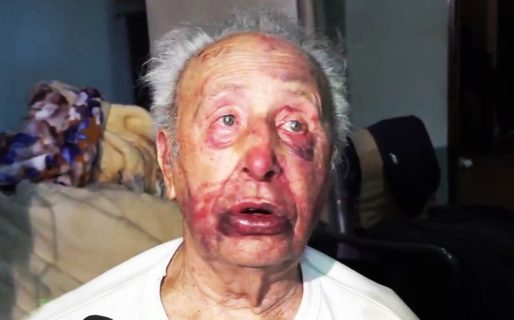 Golpearon a un jubilado para robarle sus ahorros: «Tenía miedo de que me maten»