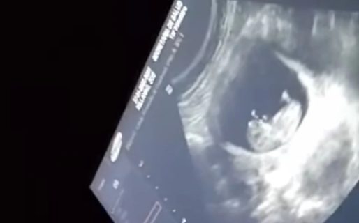 La mamá del joven apuñalado mostró la ecografía de su nieto: «La salvación de mi hijo»