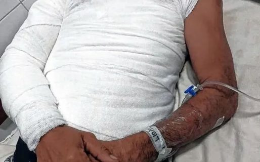 Un hombre roció con combustible a su hermano y lo prendió fuego por una mayonesa