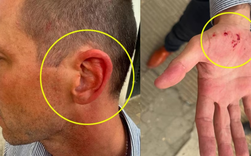 Una mujer agredió a su expareja 22 veces en dos semanas