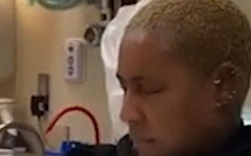 Una mujer confundió pegamento para uñas con gotas para los ojos y según los médicos tardará meses en recuperarse