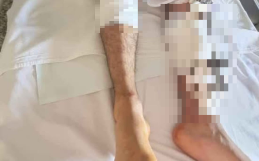 Iba a trabajar, lo atropellaron y le quebraron las dos piernas: «Te vamos a encontrar»