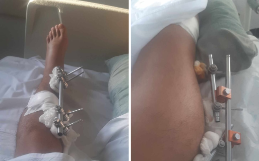 Maximiliano debe afrontar un año sin trabajar luego de un incidente de tránsito donde lo dejaron abandonado