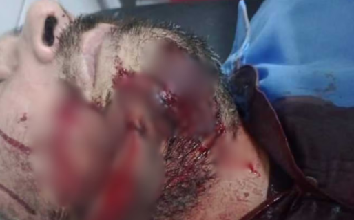 Le desfiguraron la cara a un colectivero con un cuchillo para robarle