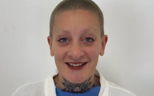 Furia Scaglione mostró cómo le quedó la nariz a un día de hacerse una cirugía estética: el video