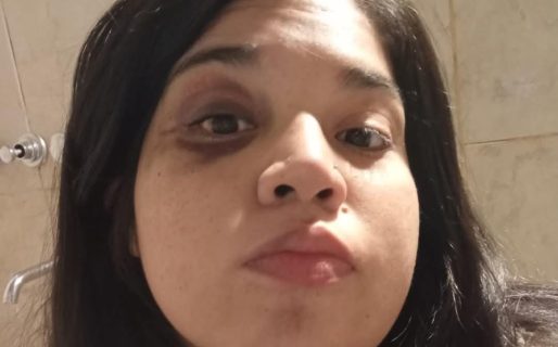 Una mujer denuncia que su expareja la golpea cada vez que la ve