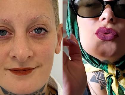 El rotundo cambio estético de Furia Scaglione tras su cirugía de nariz: las fotos del resultado final