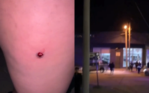 Balas de goma y disturbios a la salida de un boliche en Comodoro