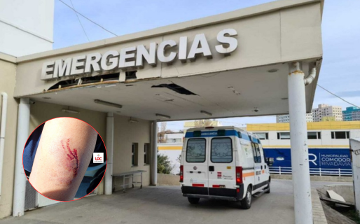 Caminaba por una avenida en Comodoro cuando fue atacada por perros sueltos