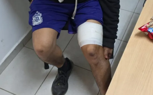 Fue a tatuarse, el ex de la tatuadora pensó que era un amante de ella y lo apuñaló