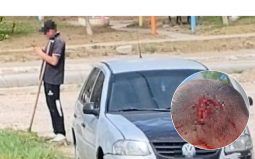 Horror en Saavedra: lo increpó por sacar fotos a viviendas y fue salvajemente golpeado