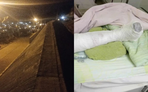 Un niño de 6 años sufrió una fractura tras caer desde un muro sin barandas en Pietrobelli