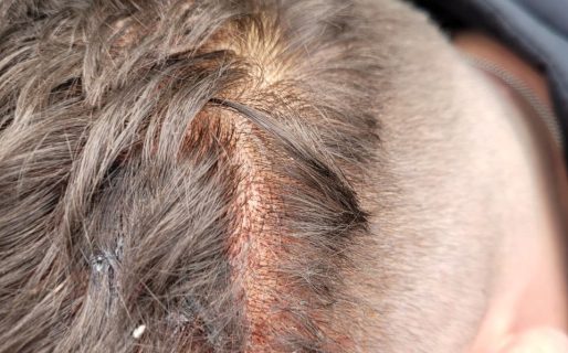 «Me quisieron cortar los dedos»: policías ingresaron a su domicilio y golpearon a toda su familia