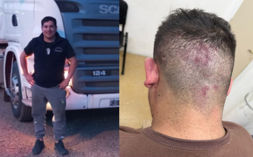 «Me entregó para que me mataran»: un hombre acusó a su jefe de planear una emboscada tras reclamar su sueldo