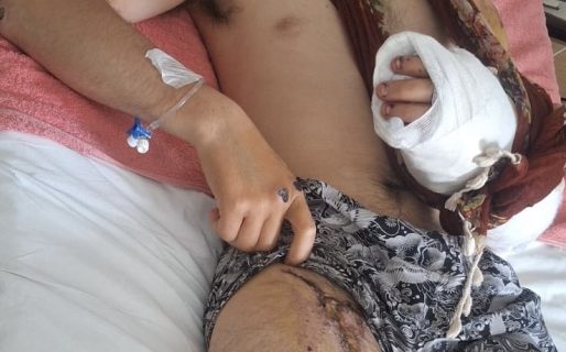 La mamá del trabajador de Pedidos Ya que fue atropellado pide colaboración para solventar gastos: “Pido empatía por mi hijo”