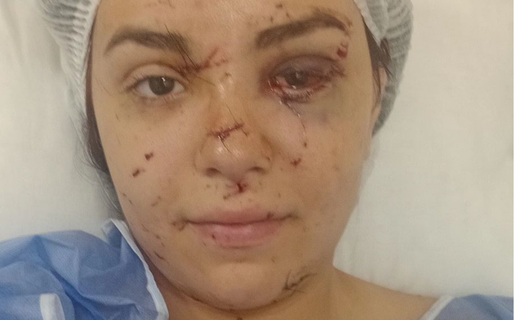 Tras la campaña solidaria, Azul superó con éxito la primera cirugía