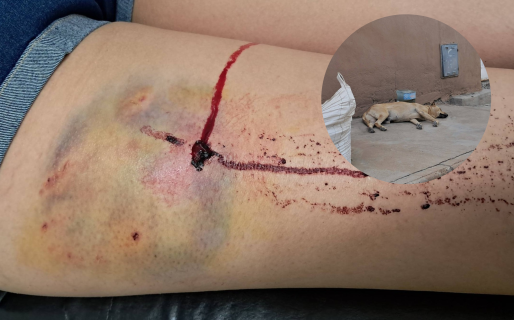 Un perro mordió a una madre que iba a dejar a su hija a la escuela y la dueña sigue sin atarlo