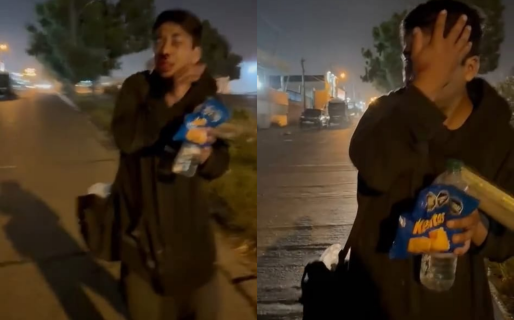 Habló el vecino que le dio una paliza a un ladrón por intentar robarle: «Creo que es poco»