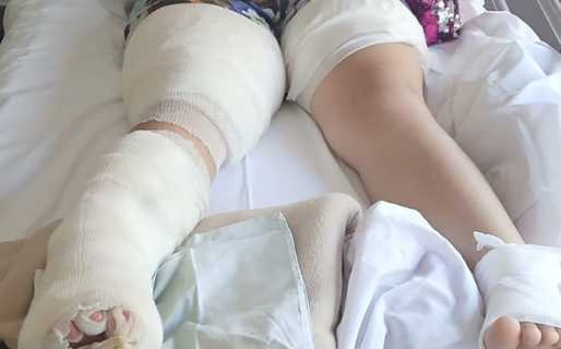 Natasha sufrió severas quemaduras y su familia apela a la comunidad ante la falta de insumos médicos