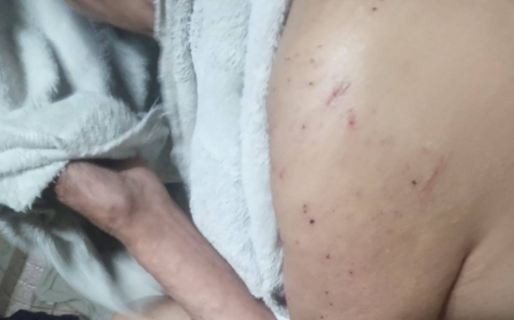 Grave denuncia en Trevelin: pidieron cerrar un geriátrico por insalubridad extrema