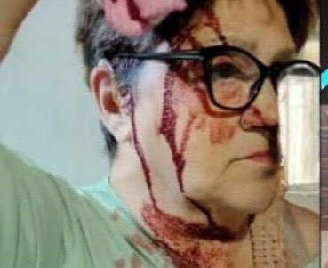 «Era como un demonio»: el crudo momento que vivió la familia agredida por la creadora de contenido para adultos