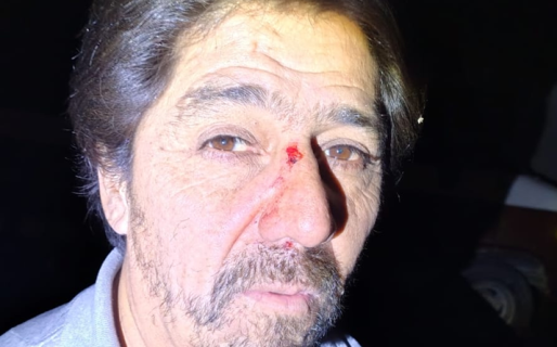 Dos mujeres asaltaron y le pegaron a un hombre mayor
