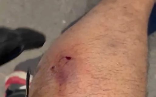 Una vecina denunció que un perro mordió a su pareja en Km 5 y apuntó contra sus dueños