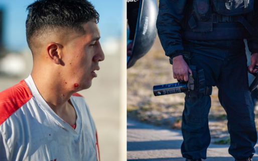Huracán avanzará con la denuncia tras el disparo que hirió a un jugador: «La policía se tiene que hacer cargo»