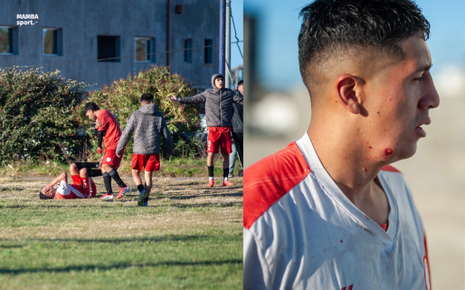 La Policía del Chubut baleó a un jugador de Huracán en el rostro