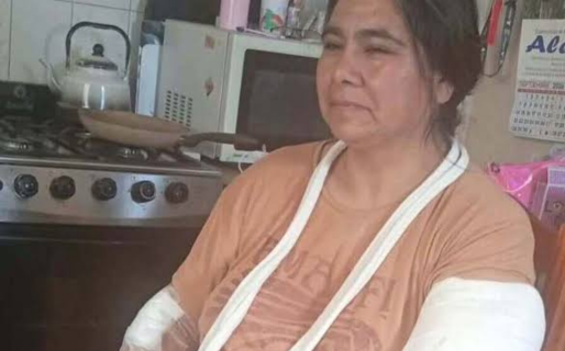 Una vecina de Trelew fue atacada por dos dogos y corre riesgo su fuente de trabajo