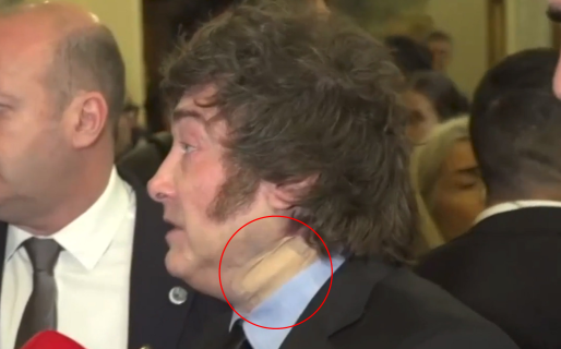 El Gobierno informó la razón por la que Javier Milei usó una venda durante su viaje a España